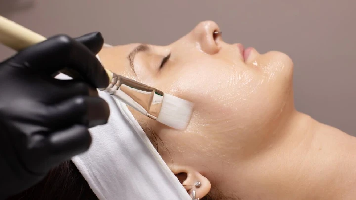 Chemical Peels: Benefits, Types, Risks, and Recovery