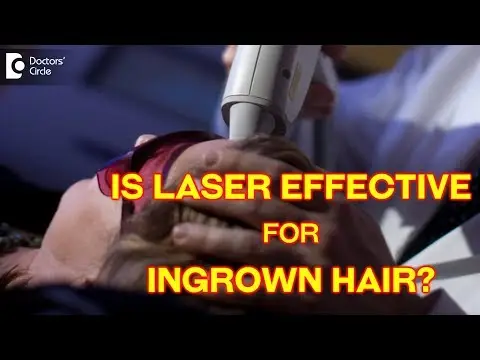 Laser Treatment