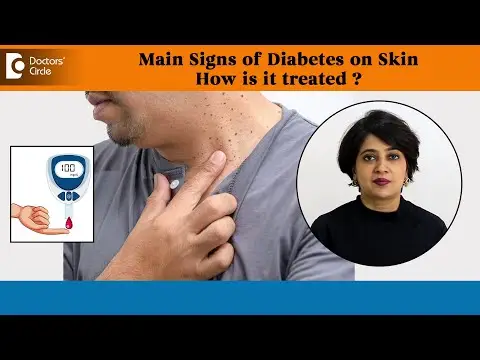 WARNING Signs of DIABETES on SKIN & Treatment