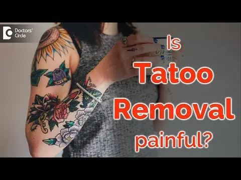 Remove Tattoo