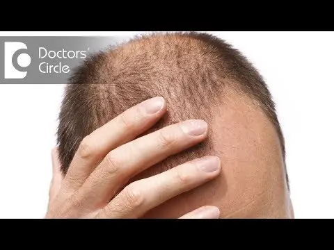 Hair loss in men