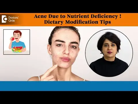 Can Nutrient Deficiency cause ACNE?| Dietary Modification Tips - Dr. Rasya Dixit