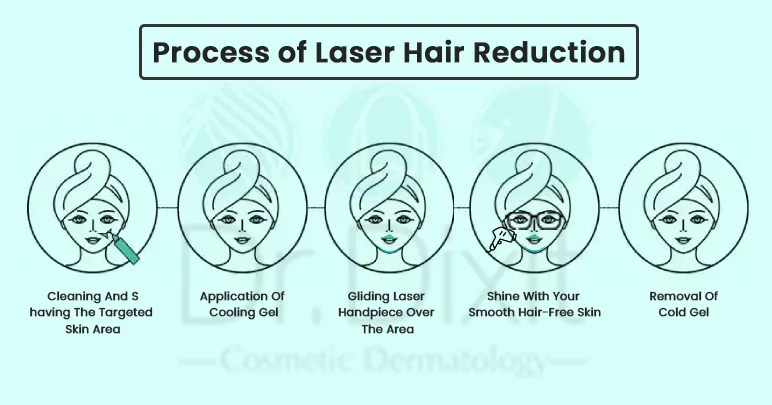 Process of Laser Hair Removal in Bangalore