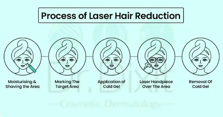 Process of Laser Hair Removal in Bangalore